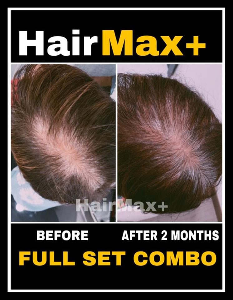 20190618 – Reduce bald spots