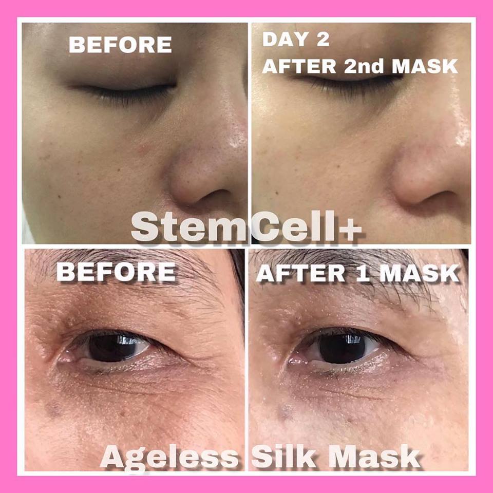 201910412 – before after